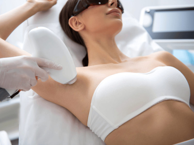 Epilation définitive à Bruxelles : préparez votre peau pour un été un toute sérénité !